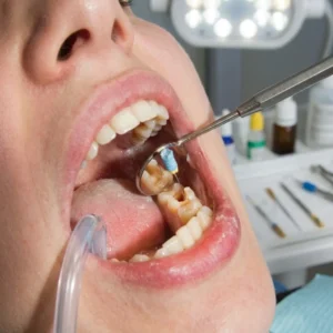endodoncia