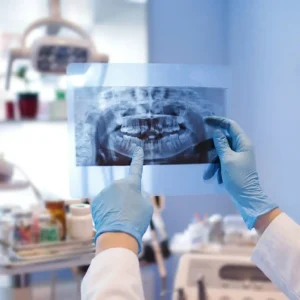 radiologia bucal y maxilofacial