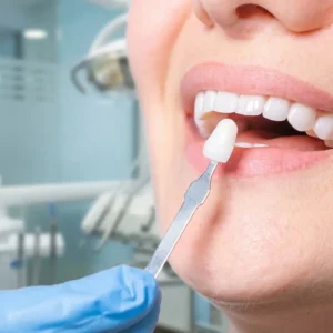 rehabilitacion oral