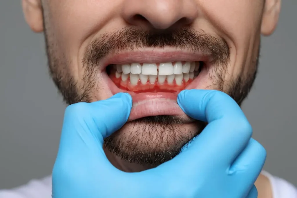 acudir al dentista por encias retraidas