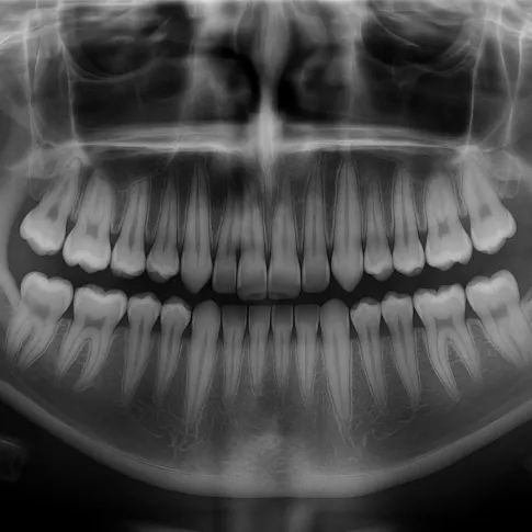 Radiografía panorámica dental